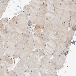 Invitrogen LLGL2 Polyclonal Antibody 100 &mu;L; Unconjugated:Antibodies,