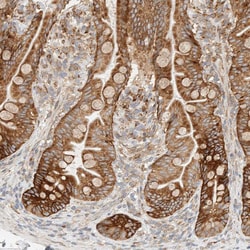 Invitrogen LLGL2 Polyclonal Antibody 100 &mu;L; Unconjugated:Antibodies,