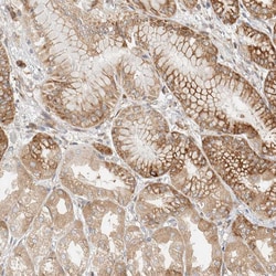 Invitrogen LLGL2 Polyclonal Antibody 100 &mu;L; Unconjugated:Antibodies,