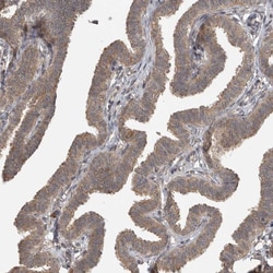 Invitrogen LLGL1 Polyclonal Antibody 100 &mu;L; Unconjugated:Antibodies,
