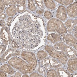 Invitrogen LLGL1 Polyclonal Antibody 100 &mu;L; Unconjugated:Antibodies,