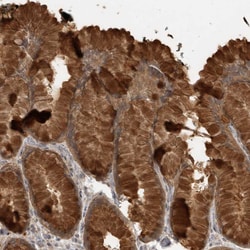 Invitrogen LLGL1 Polyclonal Antibody 100 &mu;L; Unconjugated:Antibodies,