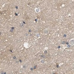 Invitrogen DCAF7 Polyclonal Antibody 100 &mu;L; Unconjugated:Antibodies,