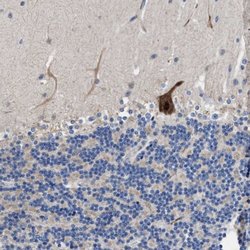Invitrogen DHRS13 Polyclonal Antibody 100 μL; Unconjugated:Antibodies,