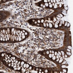 Invitrogen MRPS7 Polyclonal Antibody 100 &mu;L; Unconjugated:Antibodies,