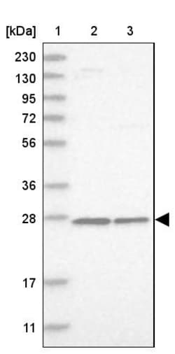 Invitrogen MRPS7 Polyclonal Antibody 100 &mu;L; Unconjugated:Antibodies,