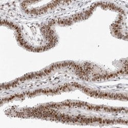 Invitrogen WRAP53 Polyclonal Antibody 100 &mu;L; Unconjugated:Antibodies,