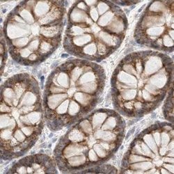 Invitrogen RNMTL1 Polyclonal Antibody 100 &mu;L; Unconjugated:Antibodies,