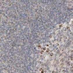Invitrogen RNMTL1 Polyclonal Antibody 100 &mu;L; Unconjugated:Antibodies,