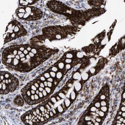 Invitrogen MRPL12 Polyclonal Antibody 100 &mu;L; Unconjugated:Antibodies,