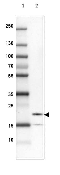 Invitrogen UBALD2 Polyclonal Antibody 100 &mu;L | Buy Online | Invitrogen&trade; | Fisher Scientific