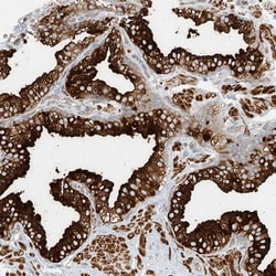 Invitrogen LYRM9 Polyclonal Antibody 100 &mu;L; Unconjugated:Antibodies,