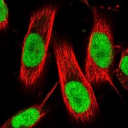 Invitrogen ZNF521 Polyclonal Antibody 100 &mu;L; Unconjugated:Antibodies,