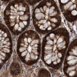 Invitrogen KIAA0753 Polyclonal Antibody 100 &mu;L; Unconjugated:Antibodies,