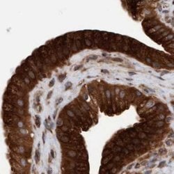 Invitrogen KIAA0753 Polyclonal Antibody 100 &mu;L; Unconjugated:Antibodies,