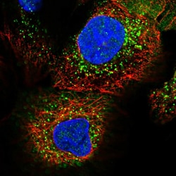 Invitrogen ADHFE1 Polyclonal Antibody 100 &mu;L; Unconjugated:Antibodies,