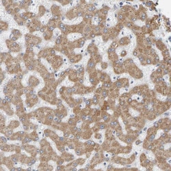 Invitrogen ADHFE1 Polyclonal Antibody 100 &mu;L; Unconjugated:Antibodies,