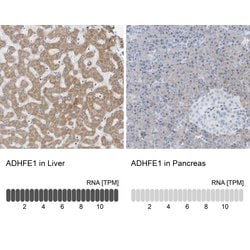 Invitrogen ADHFE1 Polyclonal Antibody 100 &mu;L; Unconjugated:Antibodies,