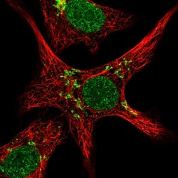 Invitrogen ZNF526 Polyclonal Antibody 100 &mu;L; Unconjugated:Antibodies,