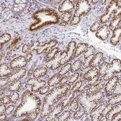 Invitrogen ZNF526 Polyclonal Antibody 100 &mu;L; Unconjugated:Antibodies,