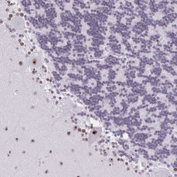 Invitrogen ZNF800 Polyclonal Antibody 100 &mu;L; Unconjugated:Antibodies,