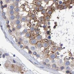 Invitrogen EFR3A Polyclonal Antibody 100 &mu;L; Unconjugated:Antibodies,