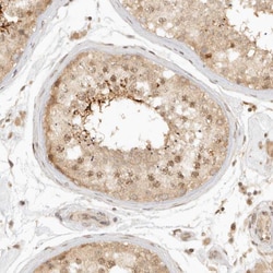 Invitrogen KIF2B Polyclonal Antibody 100 &mu;L; Unconjugated:Antibodies,