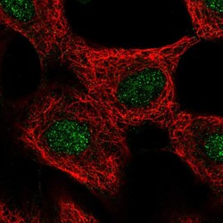 Invitrogen GLI4 Polyclonal Antibody 100 &mu;L; Unconjugated:Antibodies,