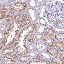 Invitrogen GLI4 Polyclonal Antibody 100 &mu;L; Unconjugated:Antibodies,