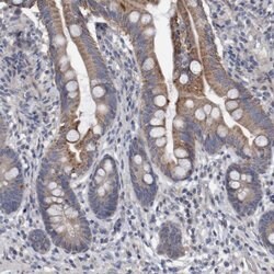 Invitrogen DDHD2 Polyclonal Antibody 100 &mu;L; Unconjugated:Antibodies,