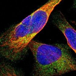 Invitrogen DDHD2 Polyclonal Antibody 100 &mu;L; Unconjugated:Antibodies,
