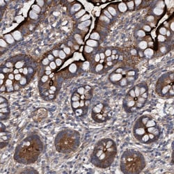 Invitrogen DDHD2 Polyclonal Antibody 100 &mu;L; Unconjugated:Antibodies,