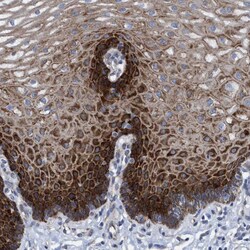 Invitrogen R3HCC1 Polyclonal Antibody 100 &mu;L; Unconjugated:Antibodies,