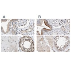 Invitrogen SLC38A10 Polyclonal Antibody 100 &mu;L; Unconjugated:Antibodies,