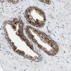 Invitrogen SLC38A10 Polyclonal Antibody 100 &mu;L; Unconjugated:Antibodies,