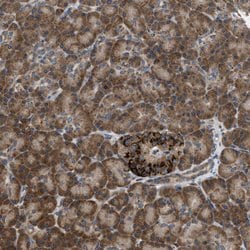 Invitrogen SLC38A10 Polyclonal Antibody 100 &mu;L; Unconjugated:Antibodies,