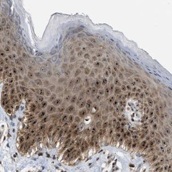 Invitrogen SLC38A10 Polyclonal Antibody 100 &mu;L; Unconjugated:Antibodies,