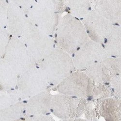 Invitrogen SLC38A10 Polyclonal Antibody 100 &mu;L; Unconjugated:Antibodies,
