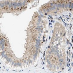 Invitrogen SLC38A10 Polyclonal Antibody 100 &mu;L; Unconjugated:Antibodies,