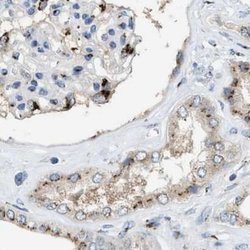 Invitrogen SLC38A10 Polyclonal Antibody 100 &mu;L; Unconjugated:Antibodies,