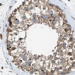 Invitrogen SLC38A10 Polyclonal Antibody 100 &mu;L; Unconjugated:Antibodies,