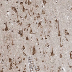 Invitrogen WWP1 Polyclonal Antibody 100 &mu;L; Unconjugated:Antibodies,