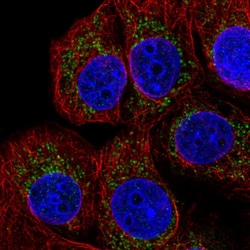 Invitrogen TMEM70 Polyclonal Antibody 100 &mu;L; Unconjugated:Antibodies,