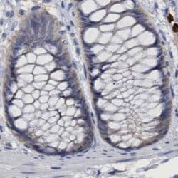 Invitrogen PNPO Polyclonal Antibody 100 &mu;L; Unconjugated:Antibodies,