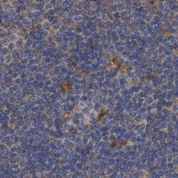 Invitrogen PNPO Polyclonal Antibody 100 &mu;L; Unconjugated:Antibodies,