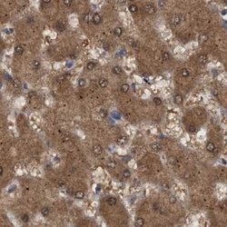 Invitrogen PNPO Polyclonal Antibody 100 &mu;L; Unconjugated:Antibodies,