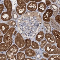 Invitrogen PNPO Polyclonal Antibody 100 &mu;L; Unconjugated:Antibodies,