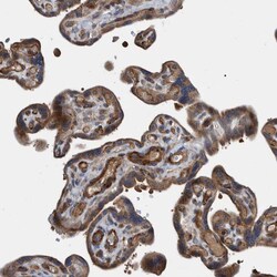 Invitrogen GRPEL2 Polyclonal Antibody 100 &mu;L; Unconjugated:Antibodies,