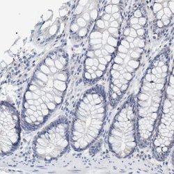 Invitrogen VSIG8 Polyclonal Antibody 100 &mu;L; Unconjugated:Antibodies,