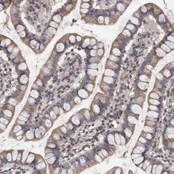 Invitrogen VSIG8 Polyclonal Antibody 100 &mu;L; Unconjugated:Antibodies,